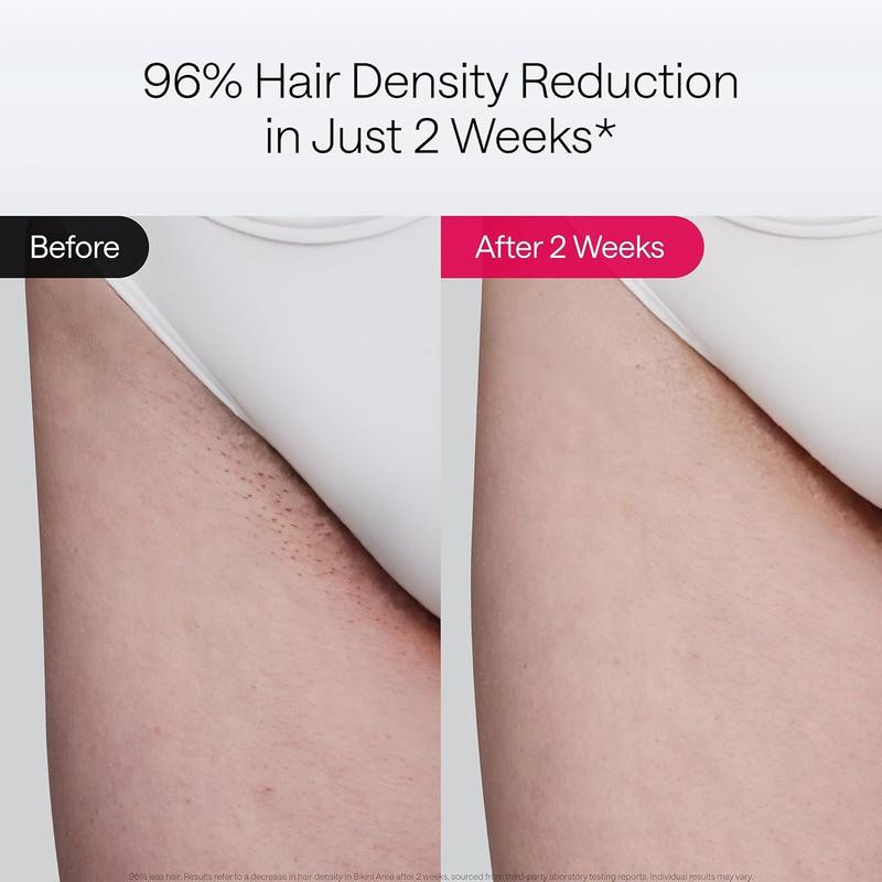 Laser Hair Removal